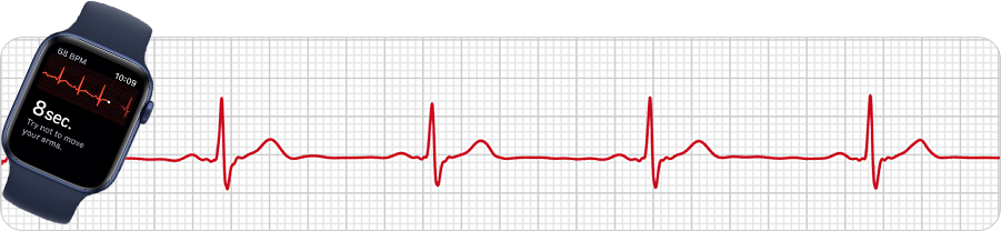 EKG svod I: apple hodinky
