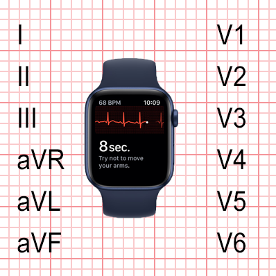 Jak natočit standardní dvanáctisvodové EKG pomocí hodinek