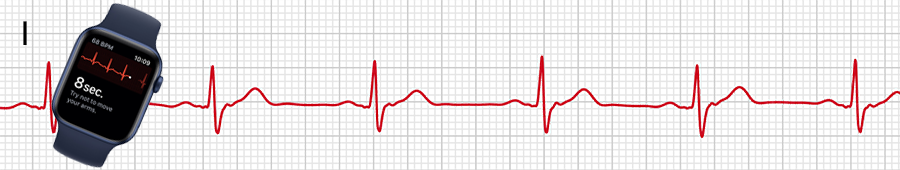 EKG apple hodinky: svod I