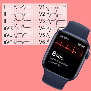 Apple EKG hodinky